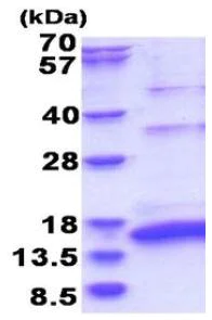 SDS-PAGE - Recombinant Hepatitis C Virus NS5a protein (AB180321)
