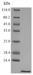 SDS-PAGE - Recombinant Hepcidin protein (AB235567)