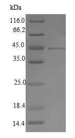 Recombinant Herpes simplex virus HSV2 gB protein (His tag) (ab225600 ...