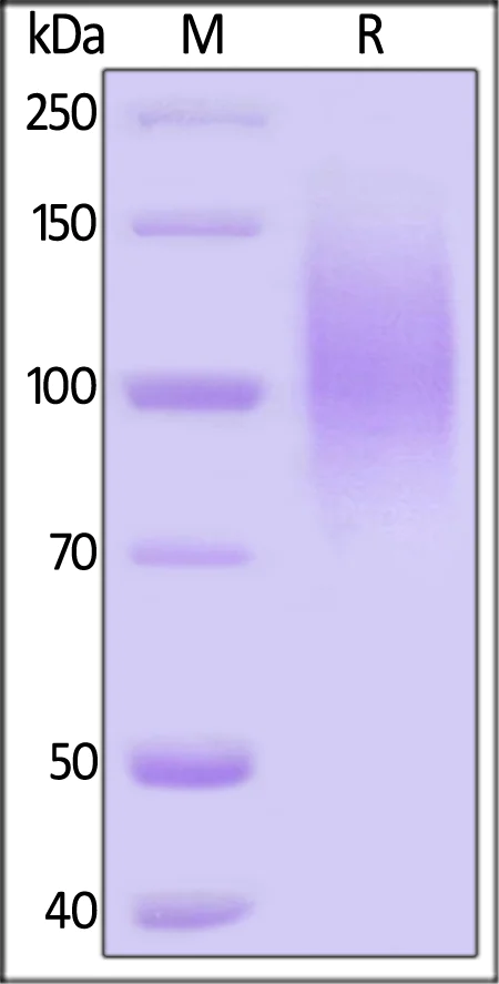 SDS-PAGE - Recombinant HIV-1 gp120 (Du172.17 (mutated E46G, T396A + A497T) protein (AB167715)