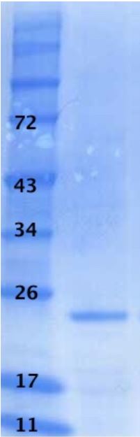 SDS-PAGE - Recombinant HIV1 p24 protein (AB43037), expandable thumbnail