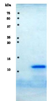 SDS-PAGE - Recombinant HIV1 Protease protein (AB215523), expandable thumbnail