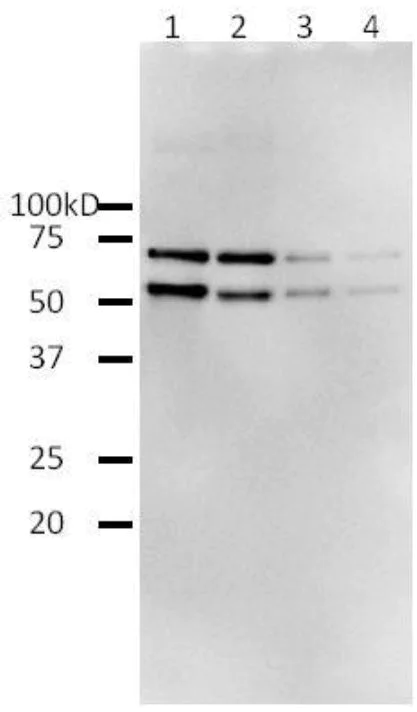 Western blot - Recombinant HIV1 Reverse Transcriptase protein (Active) (AB63979)