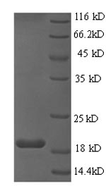 SDS-PAGE - Recombinant HPV16 E6 protein (His tag) (AB226447), expandable thumbnail