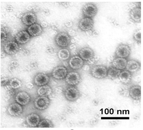 Electron Microscopy - Recombinant HPV16 L1 protein (AB119880), expandable thumbnail