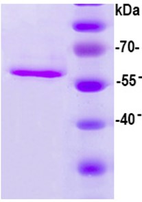 SDS-PAGE - Recombinant HPV16 L1 protein (AB119880), expandable thumbnail