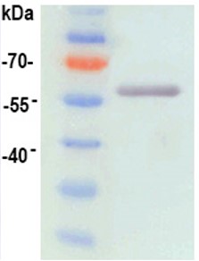 Western blot - Recombinant HPV16 L1 protein (AB119880), expandable thumbnail