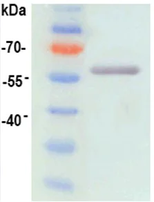 Western blot - Recombinant HPV16 L1 protein (AB119880)