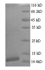 SDS-PAGE - Recombinant HPV18 E7 protein (His tag) (AB238369)