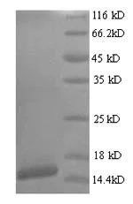 SDS-PAGE - Recombinant HPV18 E7 protein (His tag) (AB238369)