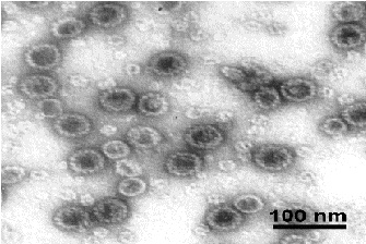 Electron Microscopy - Recombinant HPV18 L1 protein (AB119881), expandable thumbnail