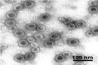 Electron Microscopy - Recombinant HPV18 L1 protein (AB119881)