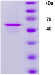 SDS-PAGE - Recombinant HPV18 L1 protein (AB119881)