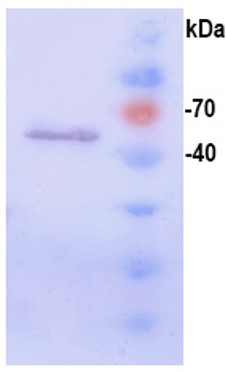 Western blot - Recombinant HPV18 L1 protein (AB119881), expandable thumbnail