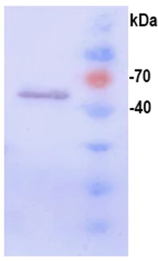 Western blot - Recombinant HPV18 L1 protein (AB119881)