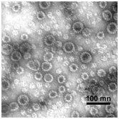 Electron Microscopy - Recombinant HPV33 L1 protein (AB119882)