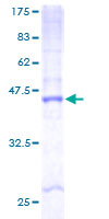 Recombinant Human 101F6 protein