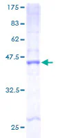 SDS-PAGE - Recombinant Human 101F6 protein (GST tag N-Terminus) (AB161278)