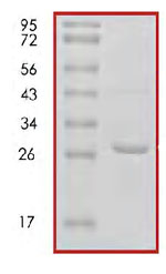 SDS-PAGE - Recombinant Human 14-3-3 Theta + Tau protein (AB85270), expandable thumbnail