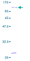 Recombinant Human 15 Lipoxygenase 1 protein
