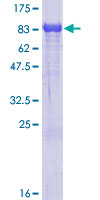 SDS-PAGE - Recombinant Human 15-LOX-2 protein (AB132282)