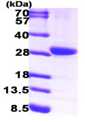 SDS-PAGE - Recombinant Human 15-PGDH protein (His tag N-Terminus) (AB99298)