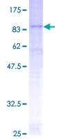 SDS-PAGE - Recombinant Human 24p3R protein (AB153343)