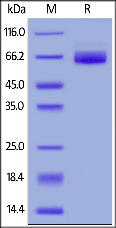 SDS-PAGE - Recombinant human 2B4 protein (Fc Chimera Active) (AB185251), expandable thumbnail