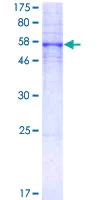 SDS-PAGE - Recombinant Human 5-HT-5A protein (AB114804)