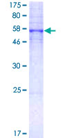 SDS-PAGE - Recombinant Human 5-HT-5A protein (AB114804)