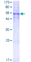 SDS-PAGE - Recombinant Human 5-HT-5A protein (GST tag N-Terminus) (AB114804)