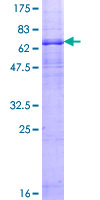 SDS-PAGE - Recombinant Human 5HT1A Receptor protein (AB132419)