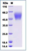 SDS-PAGE - Recombinant Human 5T4 protein (His tag) (AB276733)