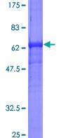 SDS-PAGE - Recombinant Human 67kDa Laminin Receptor protein (AB114294), expandable thumbnail