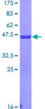 SDS-PAGE - Recombinant Human 67kDa Laminin Receptor protein (GST tag N-Terminus) (AB112316)