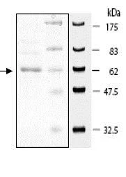 SDS-PAGE - Recombinant human A-Raf protein (GST N-Terminus + 6x His tag C-Terminus) (AB79795)