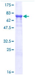 Recombinant Human A1BG protein