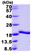 SDS-PAGE - Recombinant Human A2LD1 protein (AB104748)