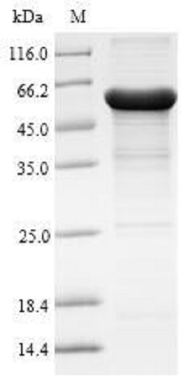 Recombinant Human AADAC/DAC protein (Tagged)