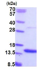 SDS-PAGE - Recombinant Human AAMDC protein (His tag N-Terminus) (AB187473)