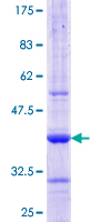 SDS-PAGE - Recombinant Human AAMP protein (AB157821), expandable thumbnail