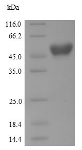 SDS-PAGE - Recombinant Human AANAT protein (Tagged) (AB239443)
