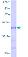 Sandwich ELISA - Recombinant Human ABAT/GABA-T protein (AB152164)