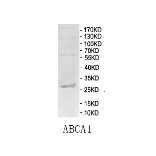 SDS-PAGE - Recombinant Human ABCA1 protein (His-DHFR) (AB125995)