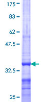 SDS-PAGE - Recombinant Human ABCA10 protein (AB160955)
