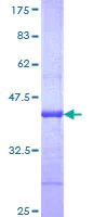 SDS-PAGE - Recombinant Human ABCA4 protein (AB114660)