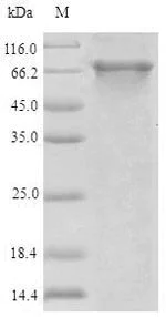SDS-PAGE - Recombinant human ABCB8 protein (His tag) (AB314521)