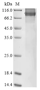 SDS-PAGE - Recombinant human ABCD2 protein (His tag) (AB314519)