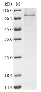 SDS-PAGE - Recombinant Human ABCD3 Protein (His Tag) (AB314608)