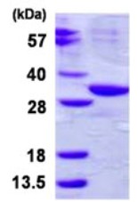 SDS-PAGE - Recombinant Human ABHD10 protein (His tag N-Terminus) (AB126655)